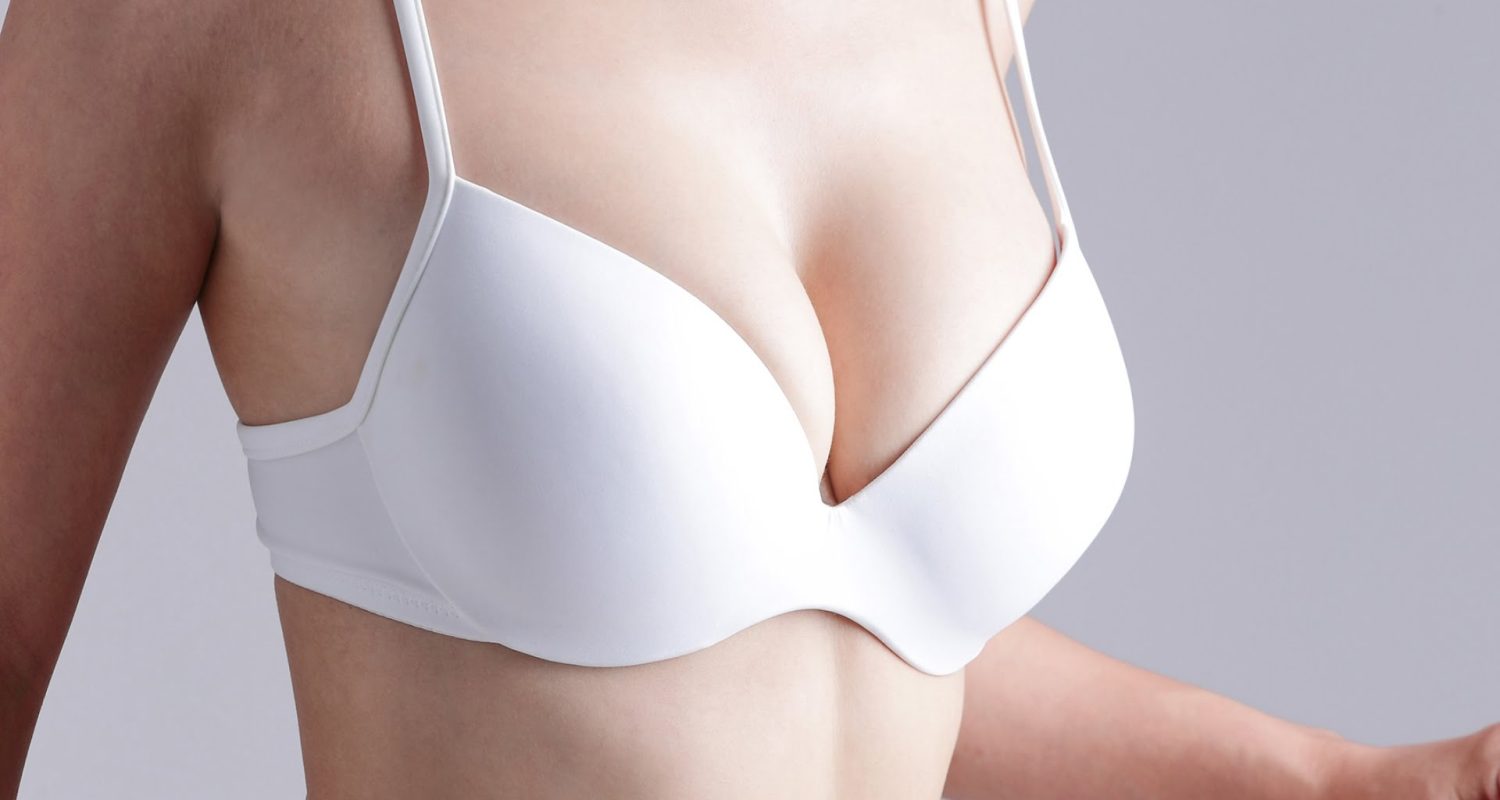 mastopexia-con-o-sin-protesis