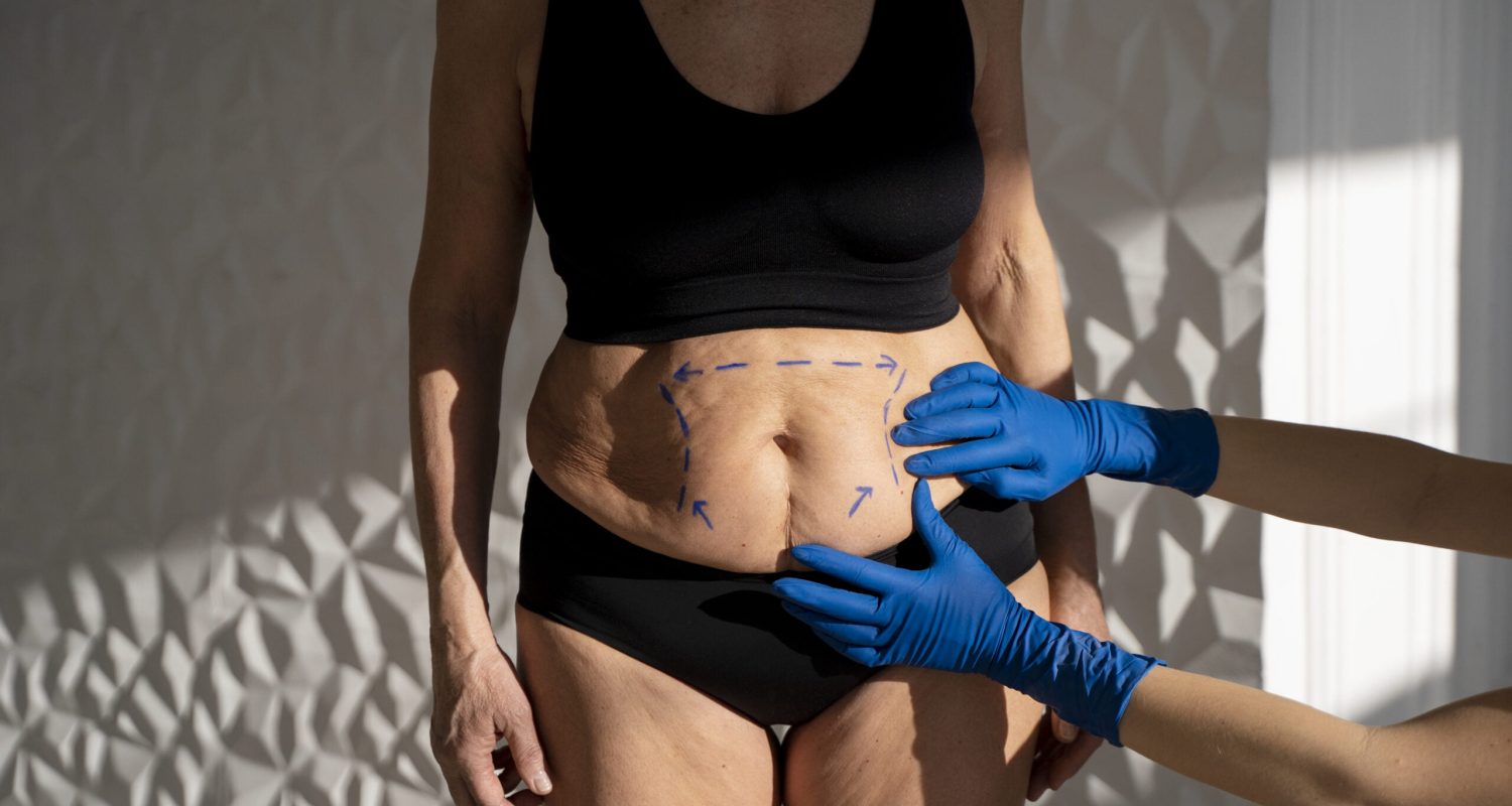 manos-guantes-cuerpo-mujer-abdominoplastia-cirugia-abdomen